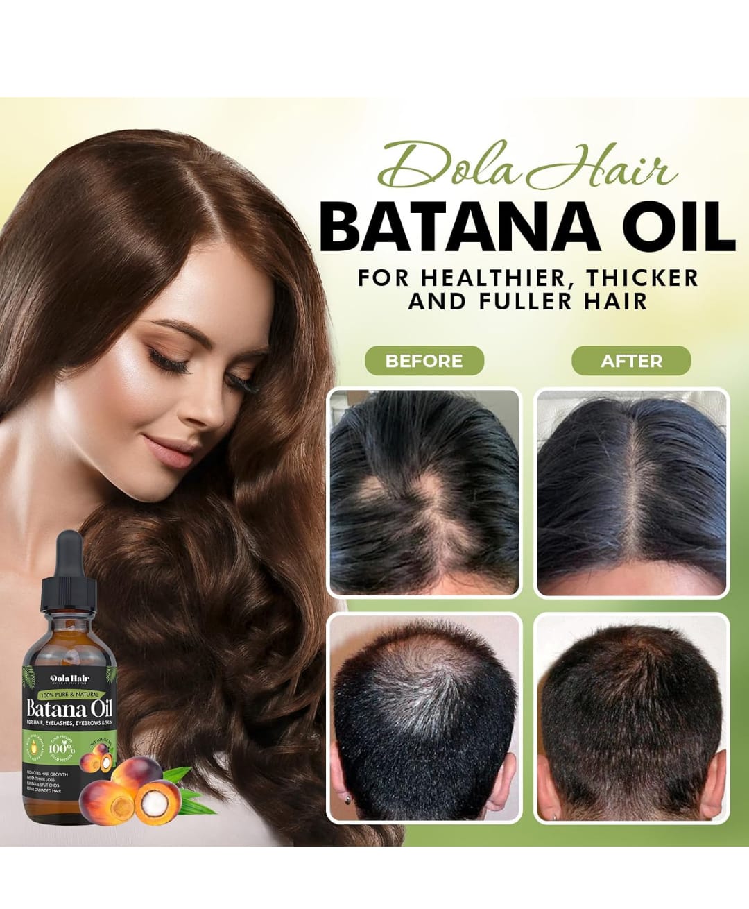 🌿🍃ACEITE DE BATANA🌿🍃 Belleza que nace desde la raíz🌿🍃
